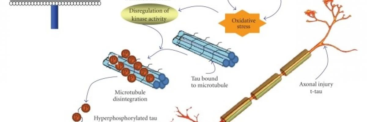 Pathological Cascade