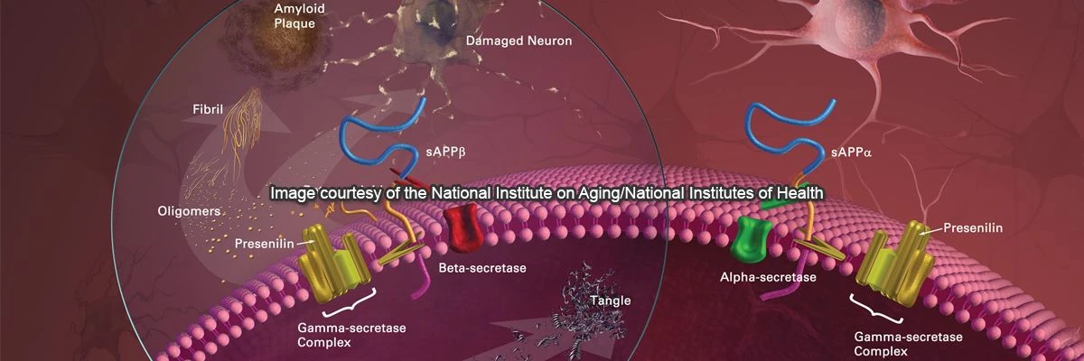 Altzheimer s Disease
